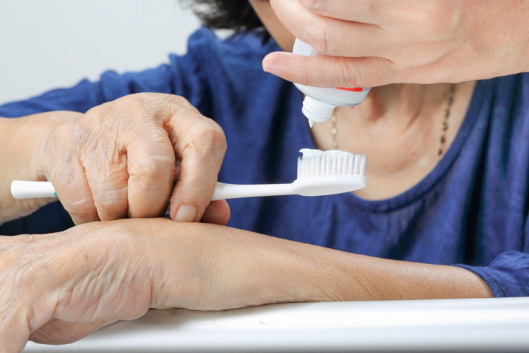 Ältere Menschen mit Demenz haben häufig eine schlechte Mundgesundheit.